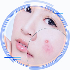 Trị Mụn - Trị Sẹo Thẩm Mỹ Keangnam Sóc Sơn