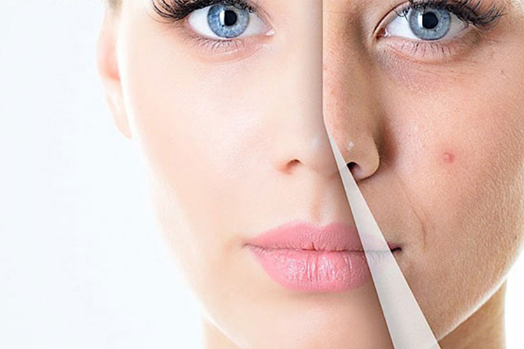 Dịch vụ điều trị mụn không để lại sẹo chuẩn y khoa tại Sóc Sơn