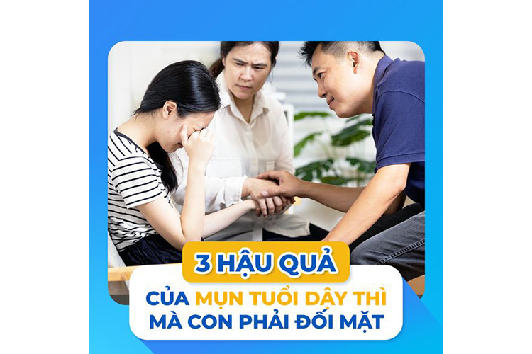 Top 3 hậu quả của Mụn Tuổi Dậy Thì mà con đang phải đối mặt